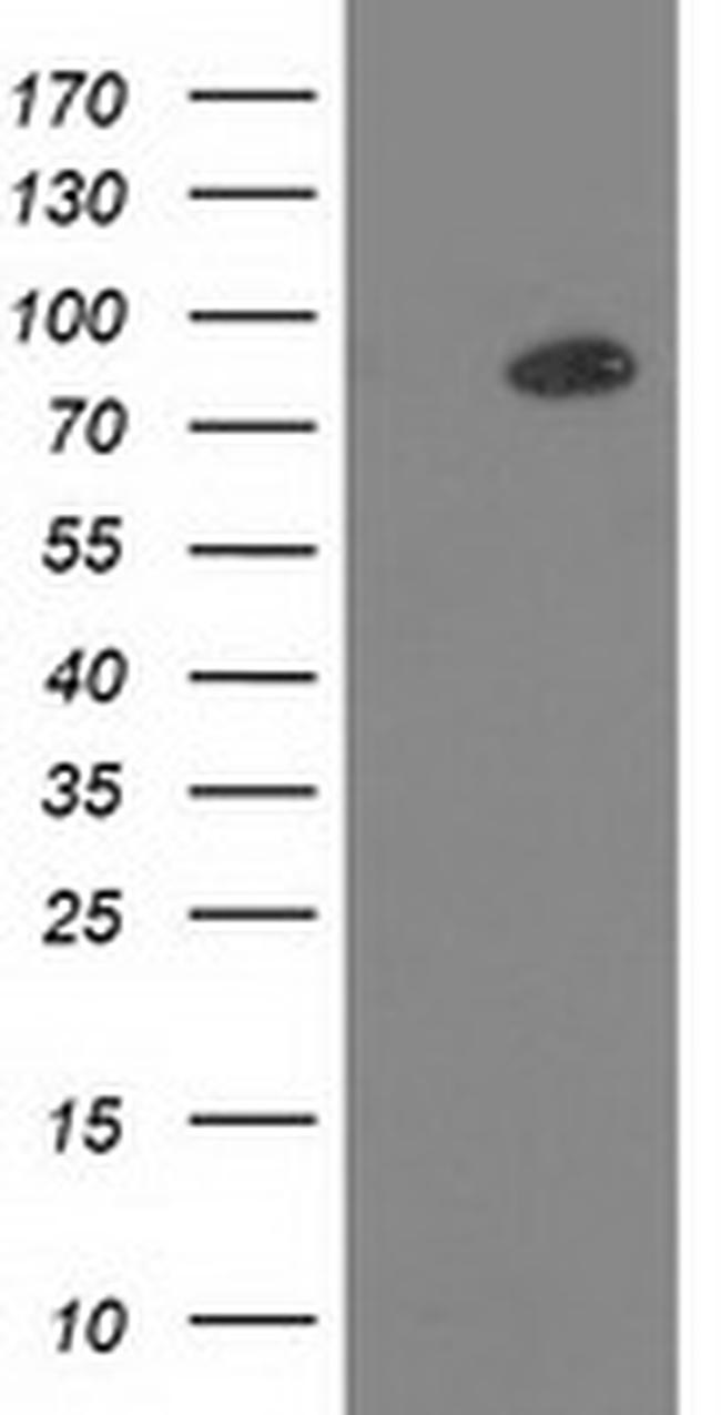 PRKCE Antibody in Western Blot (WB)