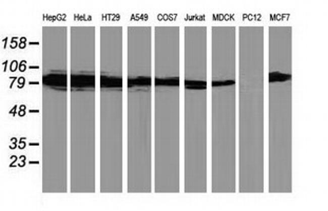 PRKCE Antibody in Western Blot (WB)