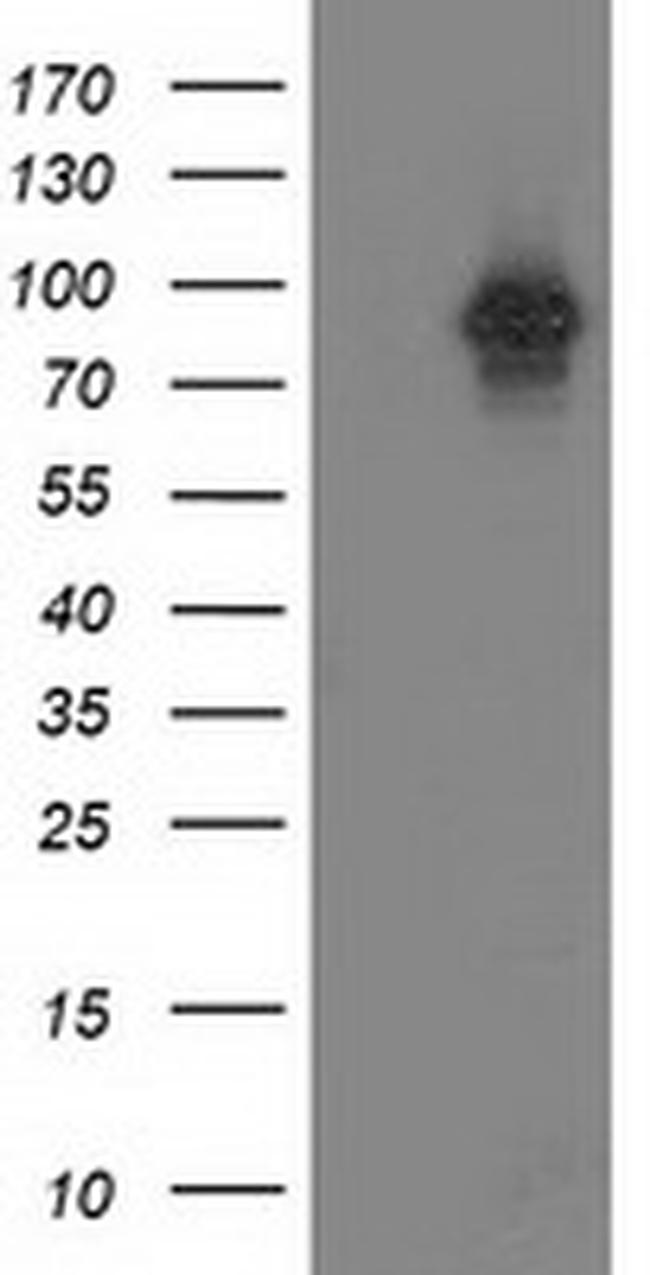 PRKCE Antibody in Western Blot (WB)