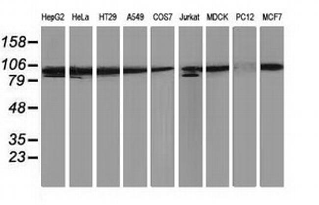 PRKCE Antibody in Western Blot (WB)