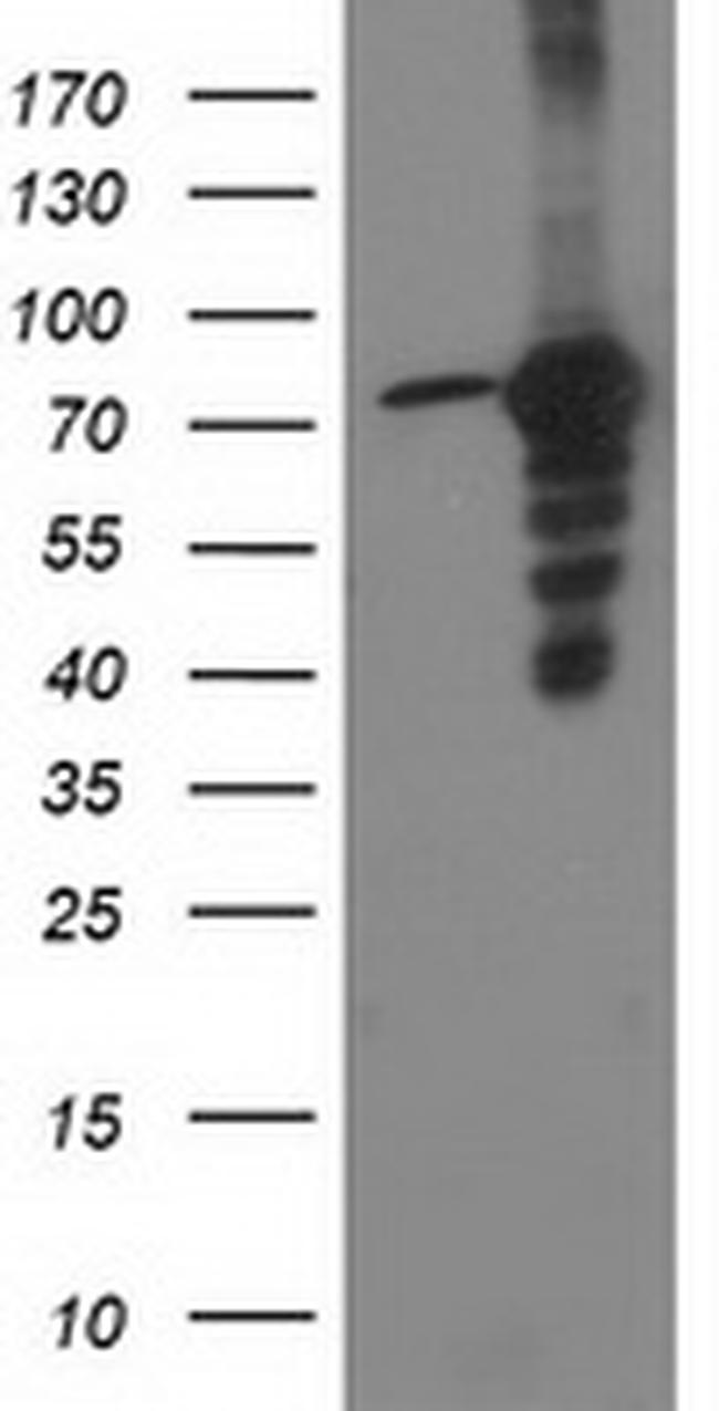 PRKCE Antibody in Western Blot (WB)