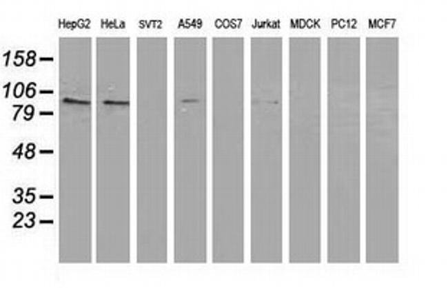 PRKCE Antibody in Western Blot (WB)