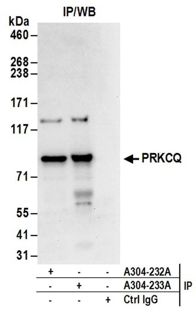 PRKCQ Antibody in Western Blot (WB)