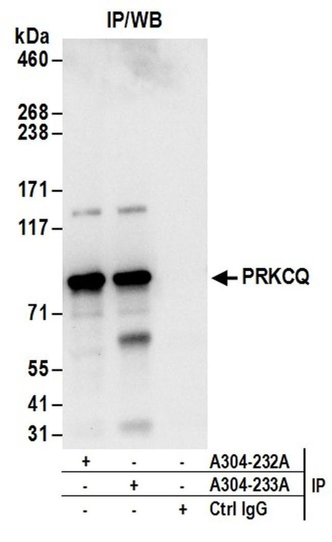 PRKCQ Antibody in Western Blot (WB)