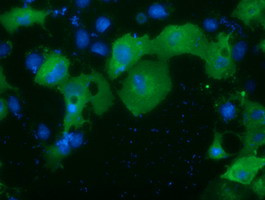 PRKD2 Antibody in Immunocytochemistry (ICC/IF)