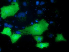 PRKD2 Antibody in Immunocytochemistry (ICC/IF)