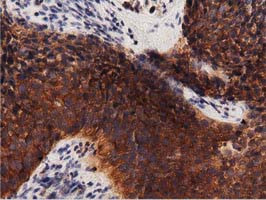 PRKD2 Antibody in Immunohistochemistry (Paraffin) (IHC (P))