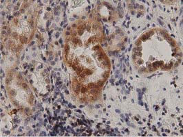 PRKD2 Antibody in Immunohistochemistry (Paraffin) (IHC (P))