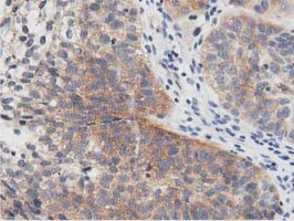 PRKD2 Antibody in Immunohistochemistry (Paraffin) (IHC (P))