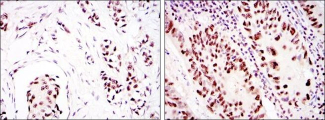 DNA-PK Antibody in Immunohistochemistry (Paraffin) (IHC (P))