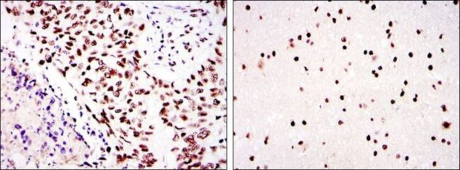 DNA-PK Antibody in Immunohistochemistry (Paraffin) (IHC (P))