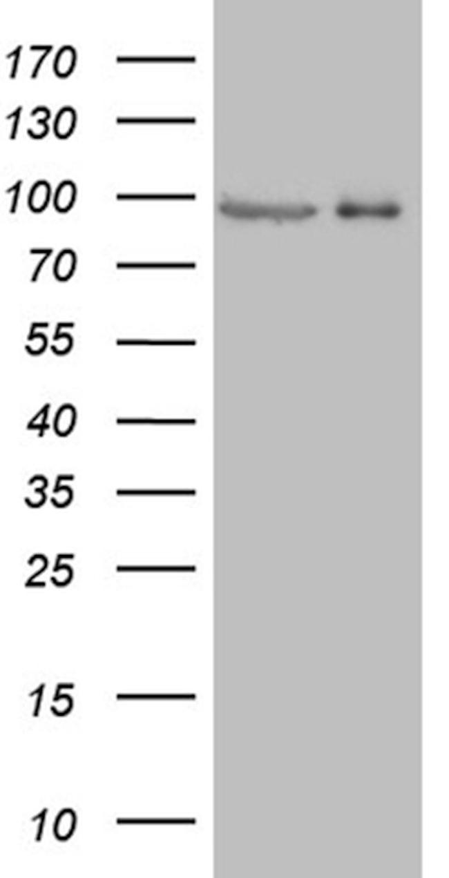 PRKG2 Antibody in Western Blot (WB)