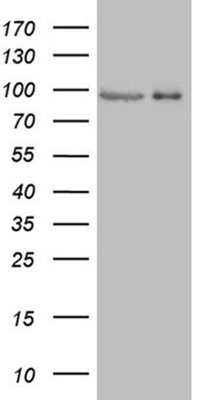 PRKG2 Antibody in Western Blot (WB)