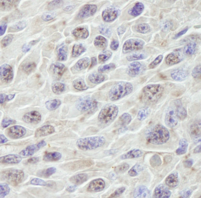 PRKRIR Antibody in Immunohistochemistry (IHC)