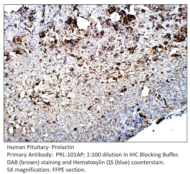 Prolactin Antibody in Immunohistochemistry (IHC)