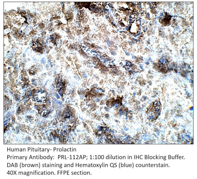 Prolactin Antibody in Immunohistochemistry (IHC)