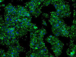 PRL Antibody in Immunocytochemistry (ICC/IF)