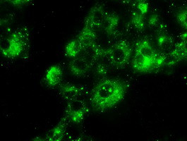 PRL Antibody in Immunocytochemistry (ICC/IF)