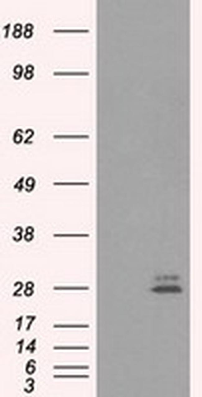 PRL Antibody in Western Blot (WB)