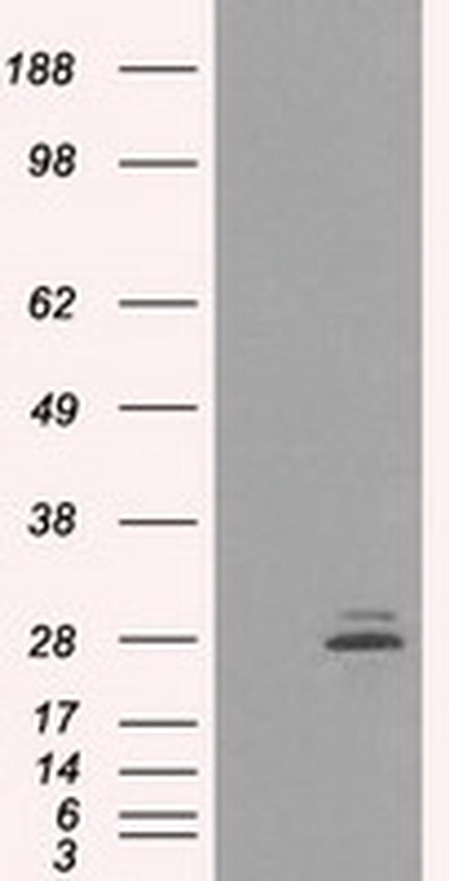 PRL Antibody in Western Blot (WB)