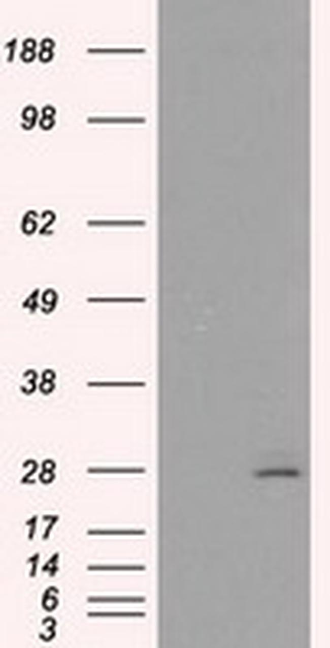 PRL Antibody in Western Blot (WB)