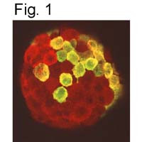 Prolactin Receptor Antibody in Immunohistochemistry (IHC)