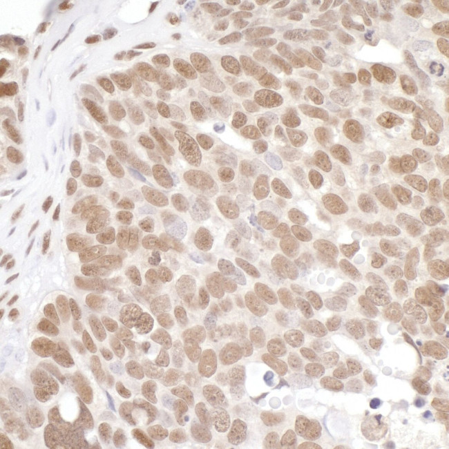 PRMT1 Antibody in Immunohistochemistry (IHC)