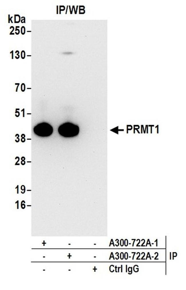 PRMT1 Antibody in Western Blot (WB)