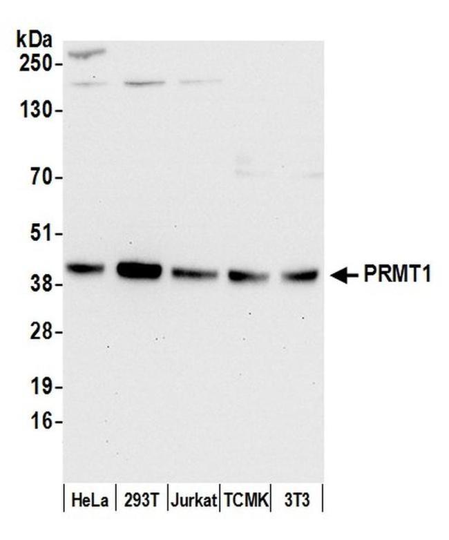 PRMT1 Antibody in Western Blot (WB)