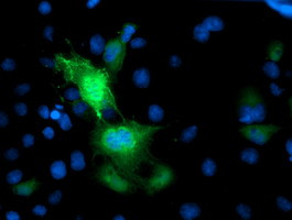 PRMT2 Antibody in Immunocytochemistry (ICC/IF)