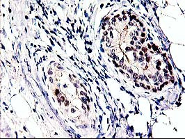 PRMT2 Antibody in Immunohistochemistry (Paraffin) (IHC (P))