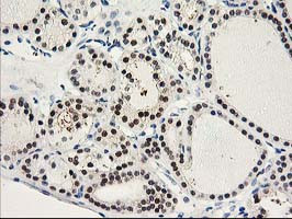 PRMT2 Antibody in Immunohistochemistry (Paraffin) (IHC (P))