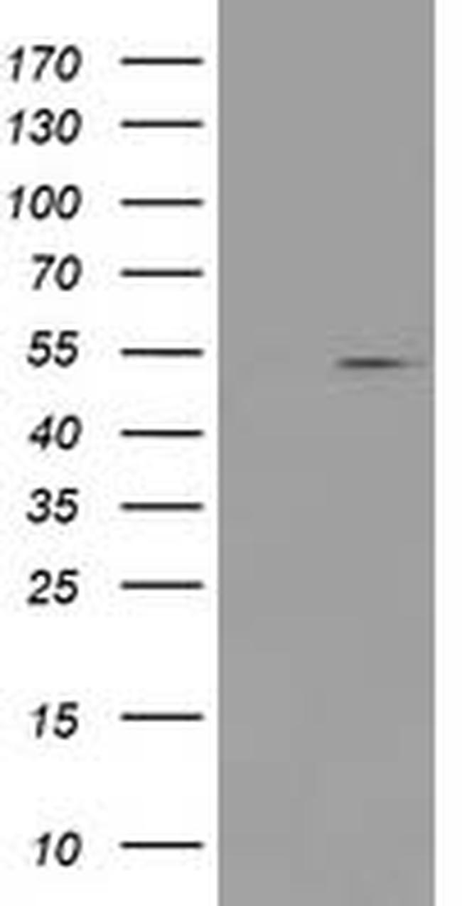 PRMT2 Antibody in Western Blot (WB)