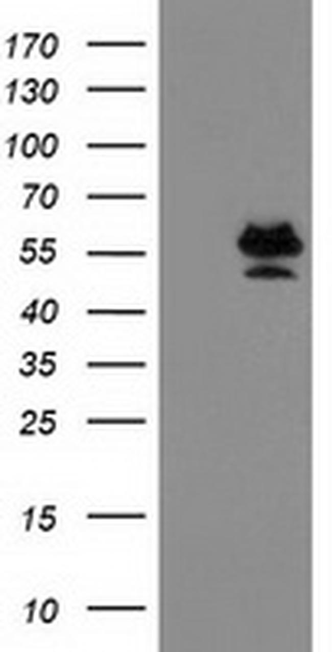 PRMT2 Antibody in Western Blot (WB)