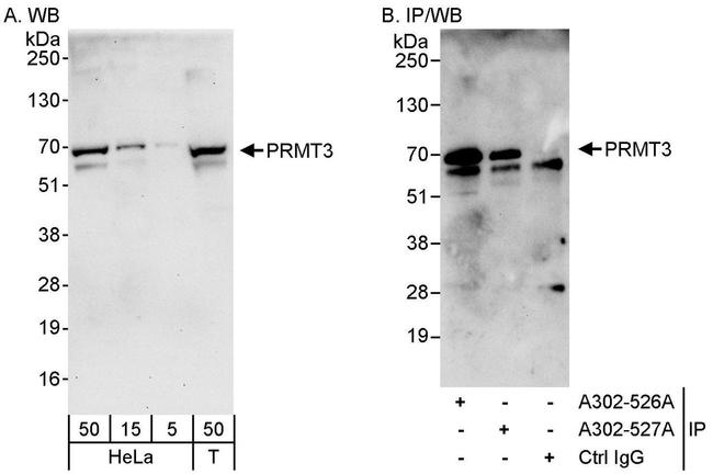 PRMT3 Antibody in Western Blot (WB)