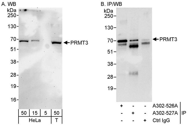 PRMT3 Antibody in Western Blot (WB)