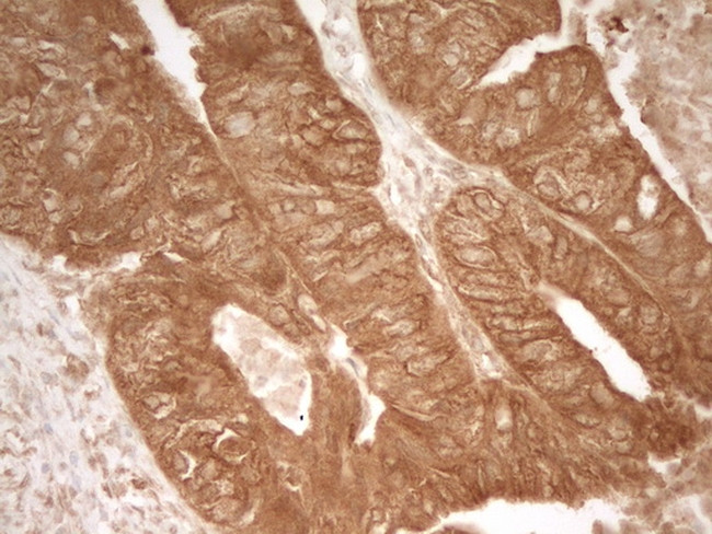 PRMT5 Antibody in Immunohistochemistry (Paraffin) (IHC (P))