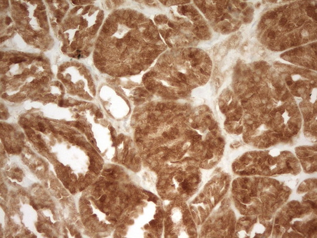 PRMT5 Antibody in Immunohistochemistry (Paraffin) (IHC (P))