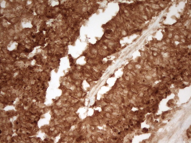 PRMT5 Antibody in Immunohistochemistry (Paraffin) (IHC (P))