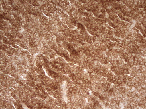 PRMT5 Antibody in Immunohistochemistry (Paraffin) (IHC (P))