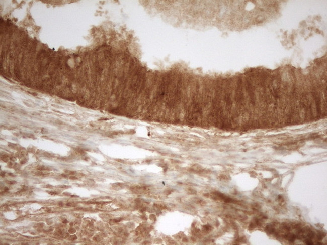 PRMT5 Antibody in Immunohistochemistry (Paraffin) (IHC (P))