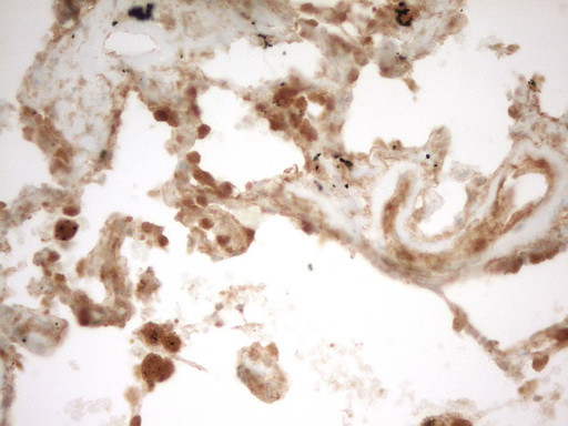 PRMT5 Antibody in Immunohistochemistry (Paraffin) (IHC (P))