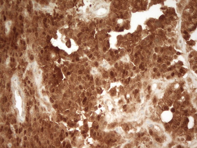 PRMT5 Antibody in Immunohistochemistry (Paraffin) (IHC (P))