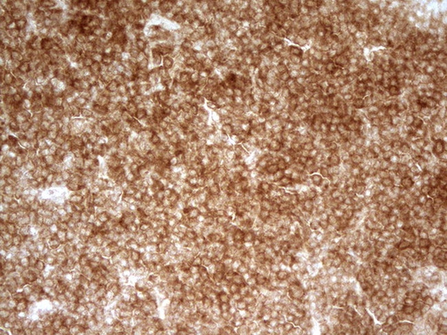 PRMT5 Antibody in Immunohistochemistry (Paraffin) (IHC (P))