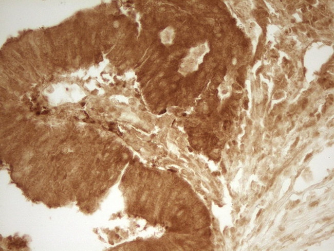 PRMT5 Antibody in Immunohistochemistry (Paraffin) (IHC (P))