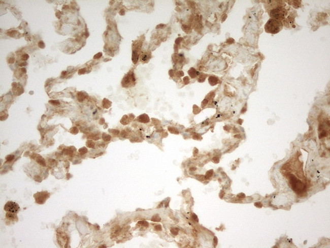 PRMT5 Antibody in Immunohistochemistry (Paraffin) (IHC (P))