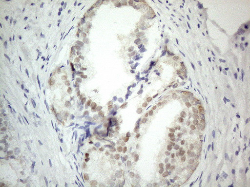 PRMT5 Antibody in Immunohistochemistry (Paraffin) (IHC (P))