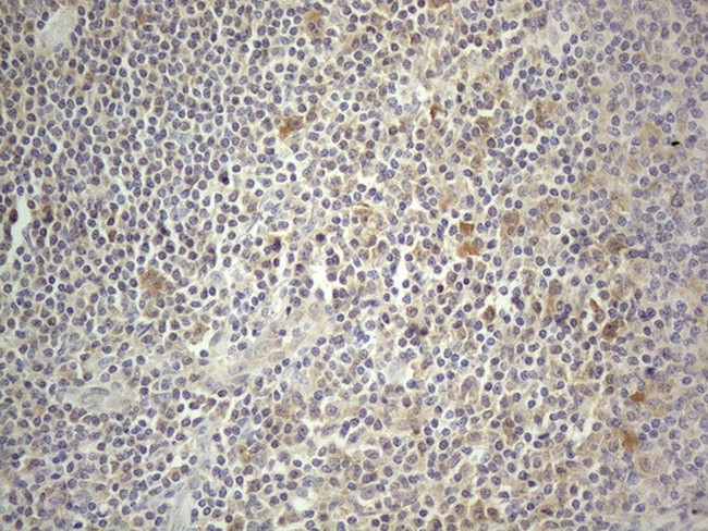 PRMT5 Antibody in Immunohistochemistry (Paraffin) (IHC (P))