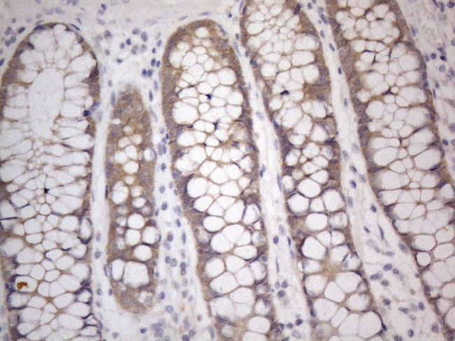 PRMT5 Antibody in Immunohistochemistry (Paraffin) (IHC (P))