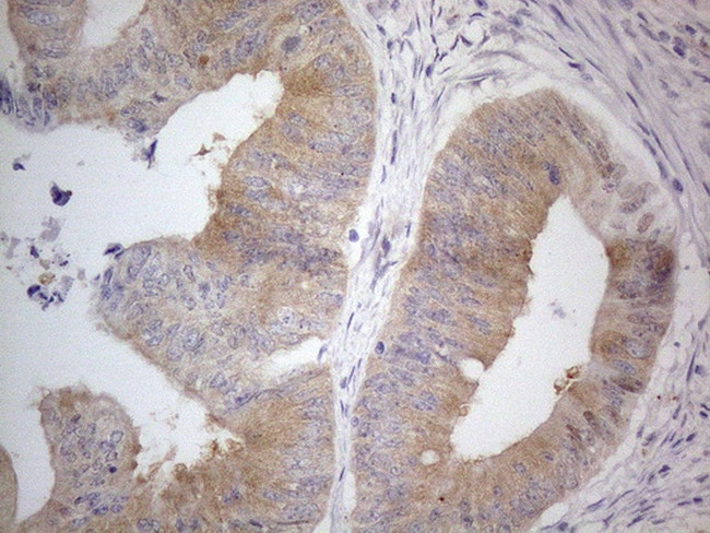 PRMT5 Antibody in Immunohistochemistry (Paraffin) (IHC (P))